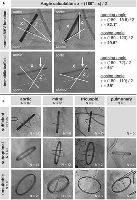 Cinefluoroscopy for assessment of mechanical heart valves with suspected dysfunction